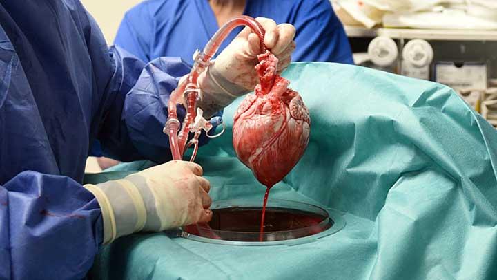 Dimodifikasi Secara Genetik, Tim Dokter AS Sukses Transplantasi Jantung Babi ke Manusia