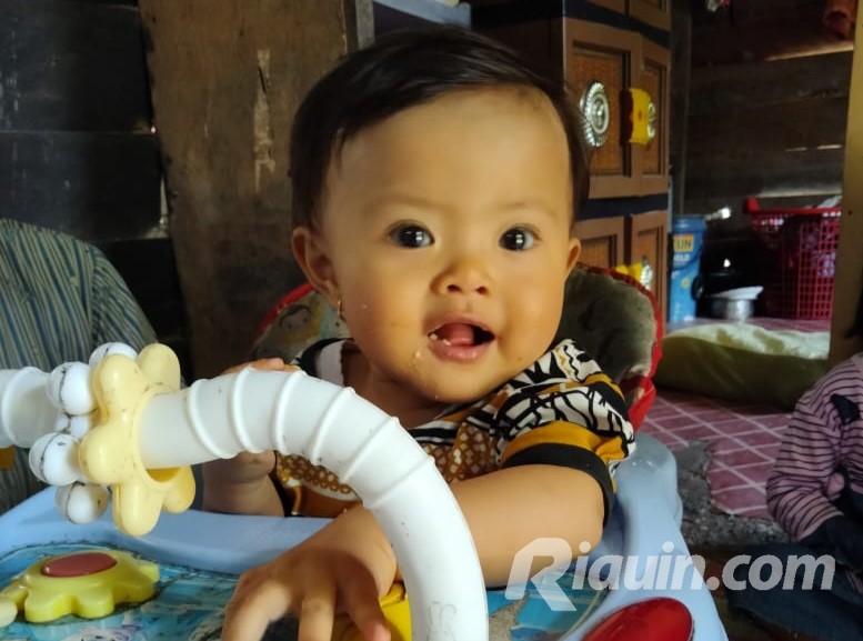 Derita Bayi 8 Bulan di Inhu Tanpa Lubang Anus, Orangtua Tak Punya Biaya Operasi
