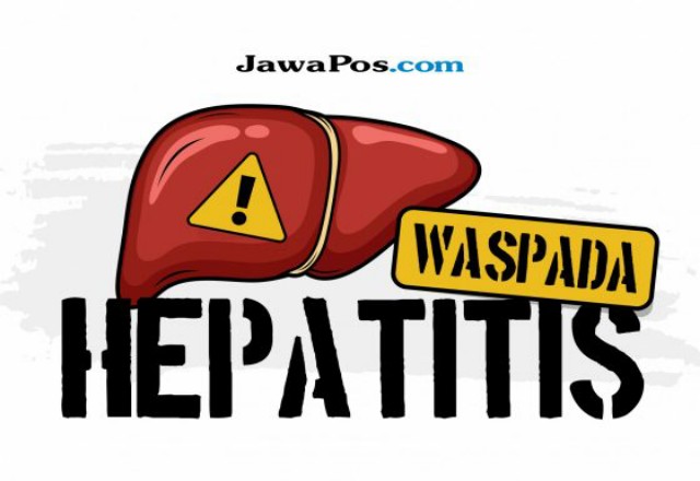 Suspek Hepatitis Misterius Ditemukan pada Dua Anak di Medan, PTM Tak Dihentikan