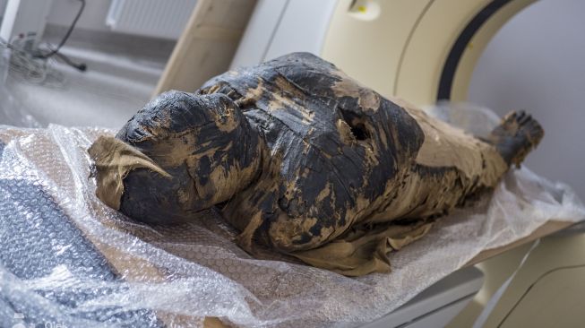 Ilmuan Polandia Temukan Mummy Perempuan Dalam Kondisi Hamil 7 Bulan